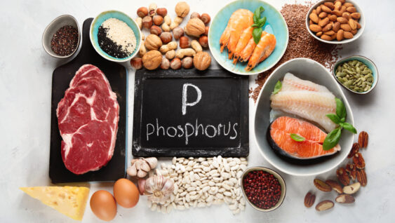 Top-view of food items containing phosphorus; Phosphorus written on blackboard surrounded by foods rich in phosphorus.